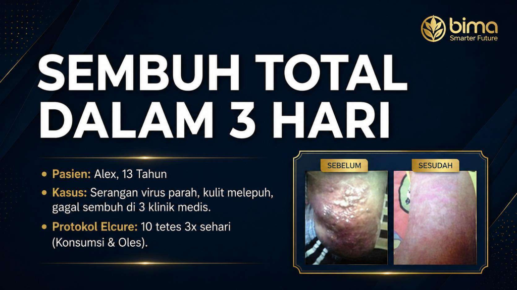 Agen Elcure Kaltara – 08995027427 – Solusi Kesehatan Berkelanjutan di Kalimantan Utara